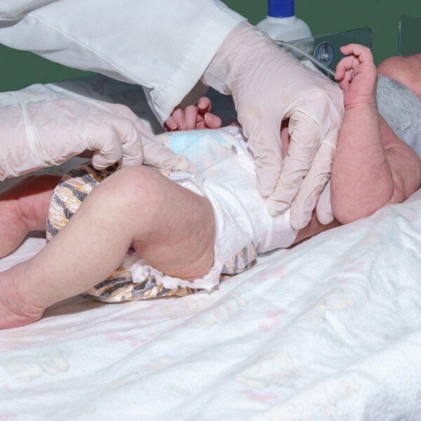 ¿Cuál es la lesión de nacimiento más común?